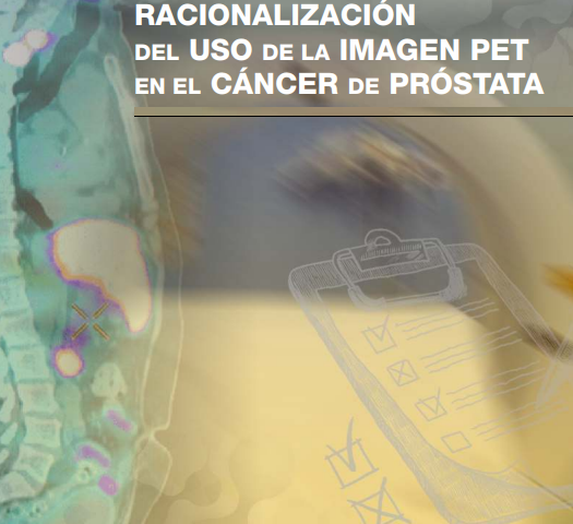 Racionalización del uso del PET en el cáncer de próstata