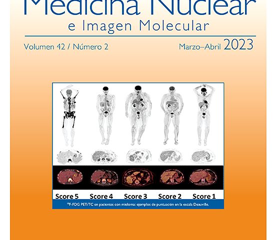 Guía del procedimiento de la PET/CT con 18F-DCFPyL